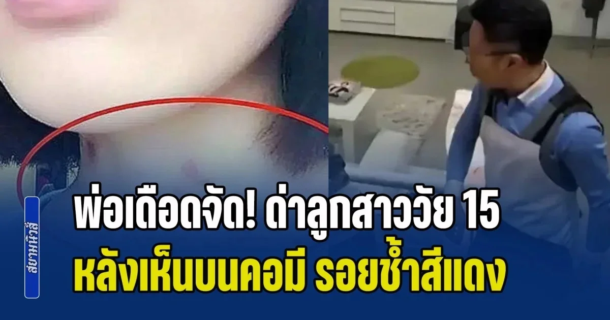 พ่อฉุนจัด! ฉะยับลูกสาววัย 15 หลังเห็นบนคอ มีรอยช้ำสีแดง แต่เจอโต้กลับ ถึงกับพูดไม่ออก (ข่าว ตปท.)