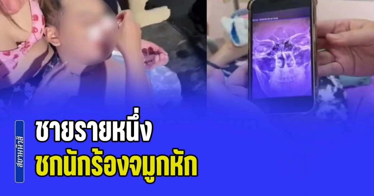 ชายรายหนึ่ง ชกนักร้องจมูกหัก กลางงานเลี้ยง