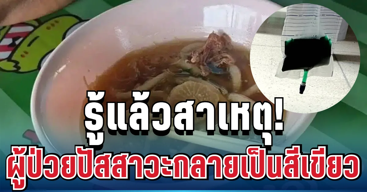 รู้แล้วสาเหตุ! ผู้ป่วยร้านก๋วยเตี๋ยวมรณะ ปัสสาวะกลายเป็นสีเขียว