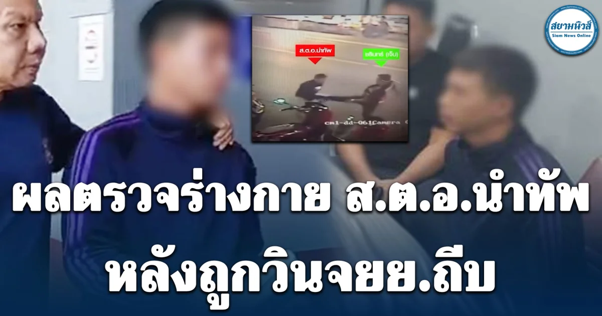 ผลตรวจร่างกาย ส.ต.อ.นำทัพ หนักเหมือนกัน หลังถูกวินจยย.ถีบ