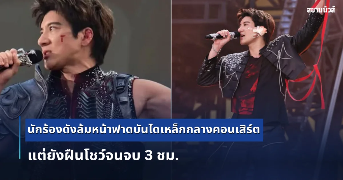 สปิริตแรงกล้า! นักร้องดังล้มหน้าฟาดบันไดเหล็กกลางคอนเสิร์ต แต่ยังฝืนโชว์จนจบ 3 ชม. (ต่างประเทศ)