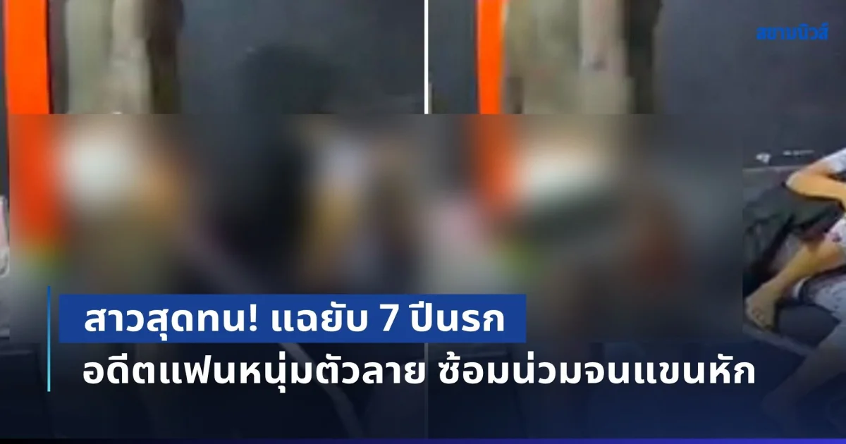 สาวสุดทน! แฉยับ 7 ปีนรก ปล่อยคลิปประจาน อดีตแฟนหนุ่มตัวลาย ซ้อมน่วมจนแขนหัก-ซึมเศร้า กินไม่ได้นอนไม่หลับ