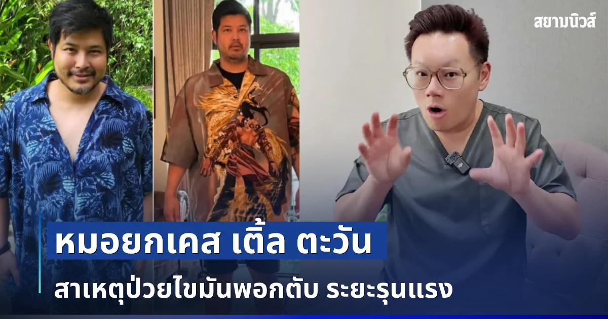 หลายคนไม่เคยรู้! หมอยกเคส เติ้ล ตะวัน สาเหตุป่วยไขมันพอกตับระยะรุนแรง