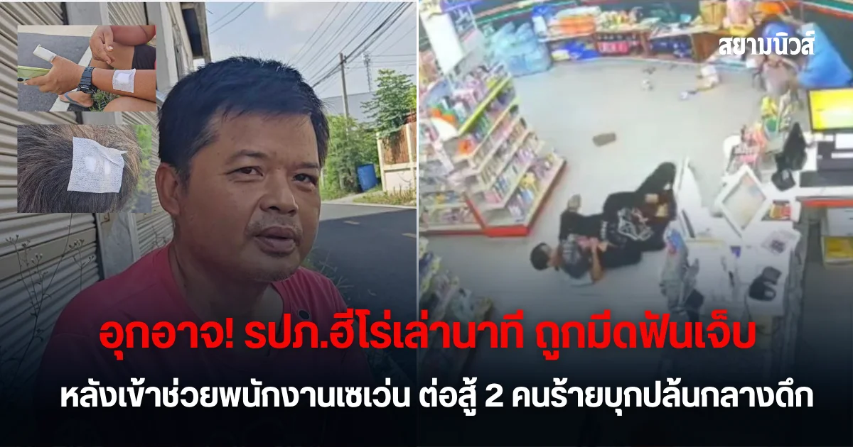 อุกอาจ! รปภ.ฮีโร่เล่านาที ถูกมีดฟันเจ็บ หลังเข้าช่วยพนักงานเซเว่น ต่อสู้ 2คนร้ายบุกปล้นกลางดึก