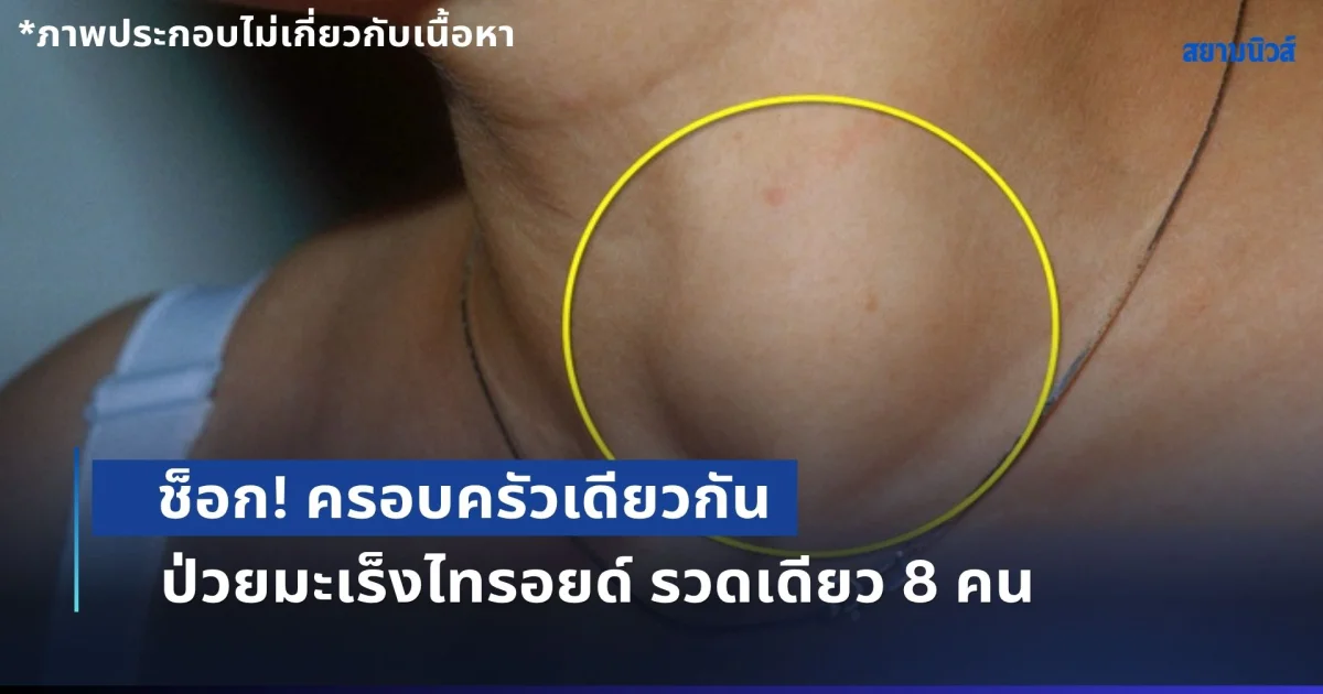 ช็อก! ครอบครัวเดียวกัน ป่วยมะเร็งไทรอยด์ รวดเดียว 8 คน หมอชี้ 5 สัญญาณเตือน หลายคนมองข้าม (ข่าว ตปท.)