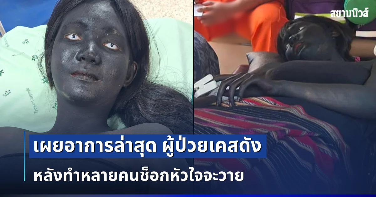 หัวใจจะวาย! เผยอาการล่าสุด ผู้ป่วยเคสดัง หลังทำหลายคนช็อกกันเป็นเเถว