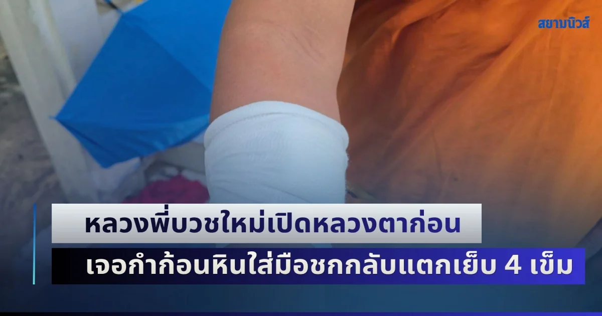 ศึกเดือดกลางพรรษา! หลวงพี่บวชใหม่เปิดหลวงตาก่อน เจอกำก้อนหินใส่มือชกกลับแตกเย็บ 4 เข็ม เหตุเพราะเรื่องกุญแจรถ