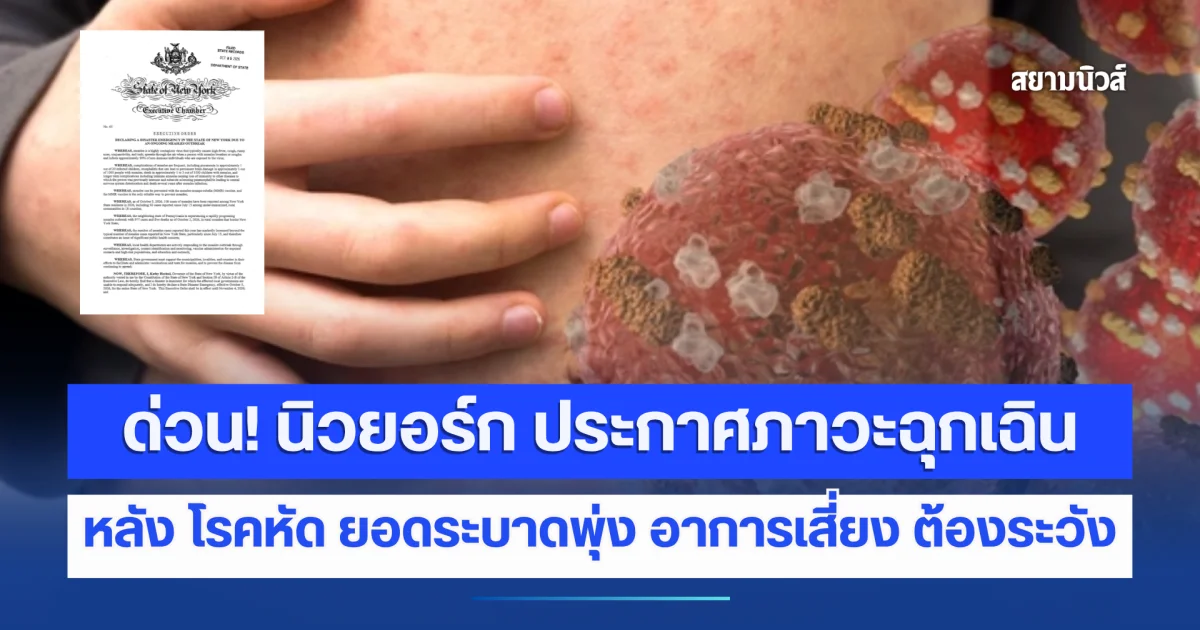 ด่วน! นิวยอร์ก ประกาศสภาวะฉุกเฉิน โรคหัด หลังยอดระบาดพุ่ง มีผู้เสียชีวิตแล้ว เผยอาการเสี่ยง ต้องระวัง