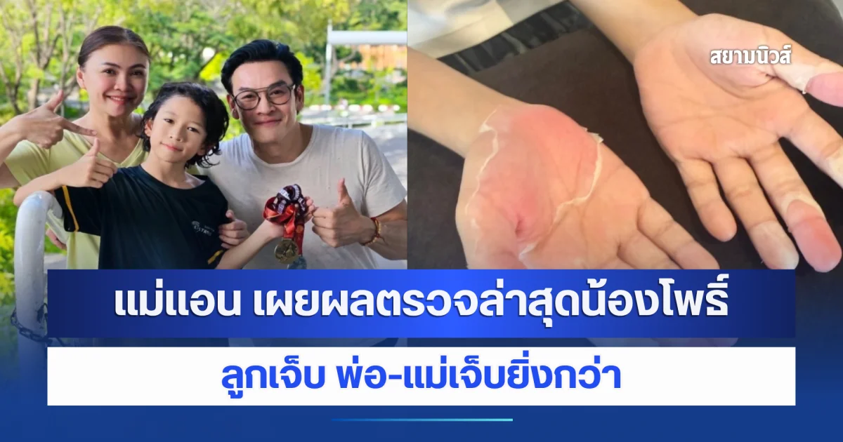 ลูกเจ็บ พ่อ-เเม่เจ็บยิ่งกว่า เเม่เเอน เผยผลตรวจล่าสุดน้องโพธิ์