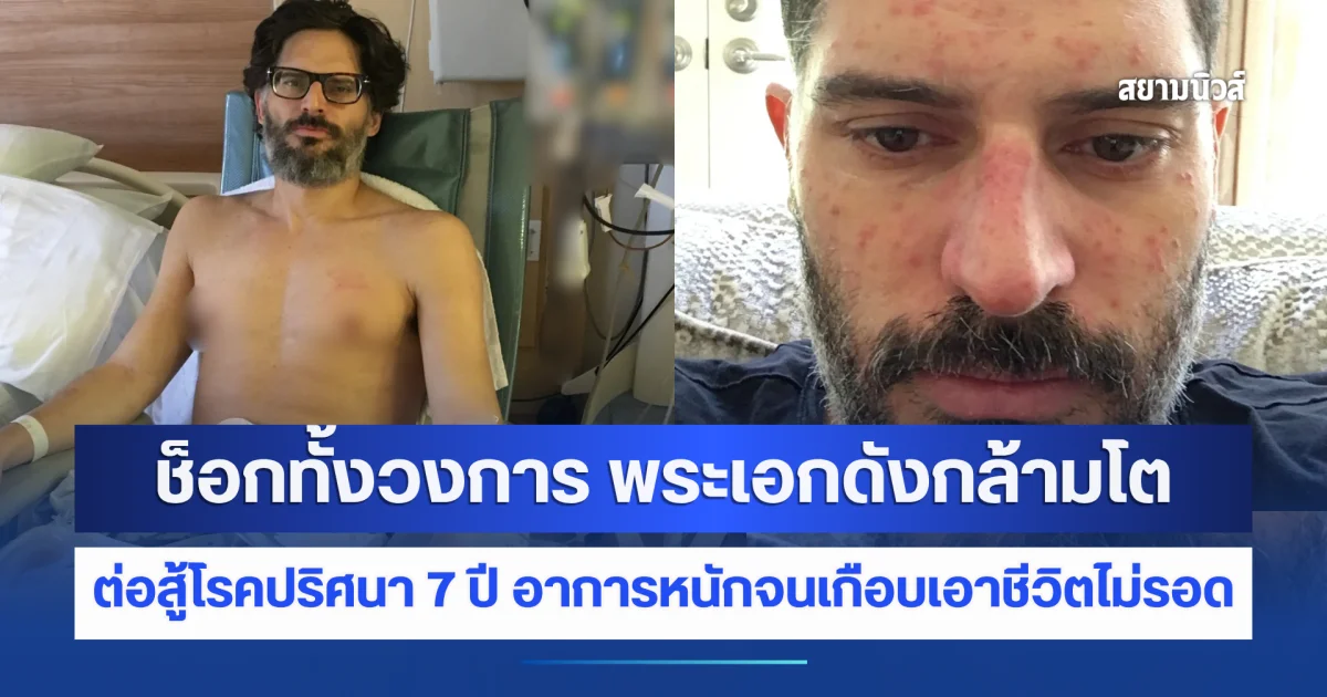 ช็อกทั้งวงการ พระเอกดัง ต่อสู้โรคปริศนา 7 ปี อาการหนักจนเกือบเอาชีวิตไม่รอด (ข่าวต่างประเทศ)